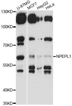 Polyclonal Rabbit anti-Human NPEPL1 Antibody (WB)