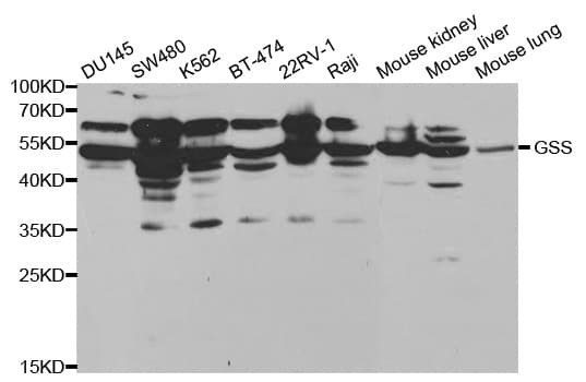 IHC-plus™ GSS / Glutathione Synthetase Antibody
