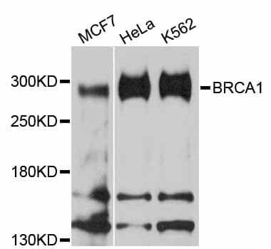 BRCA1 Antibody