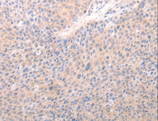 ACO1 / Aconitase Antibody