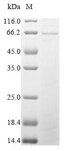 Aspergillus niger gox / Glucose Oxidase Protein (Recombinant 10His, N-terminus)