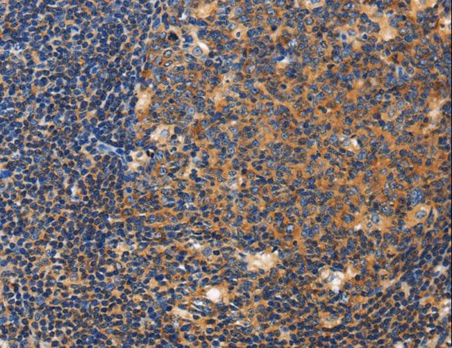 Polyclonal Rabbit anti-Human Ceramide Kinase / CERK Antibody (IHC)
