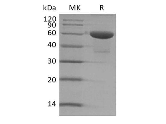 Human TMED1 / ST2L Protein (Recombinant Fc, C-terminus)