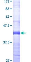 Human ABCC4 / MRP4 Protein (Recombinant GST, N-terminus)