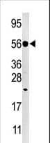 IHC-plus™ DUSP8 Antibody (aa456-487)