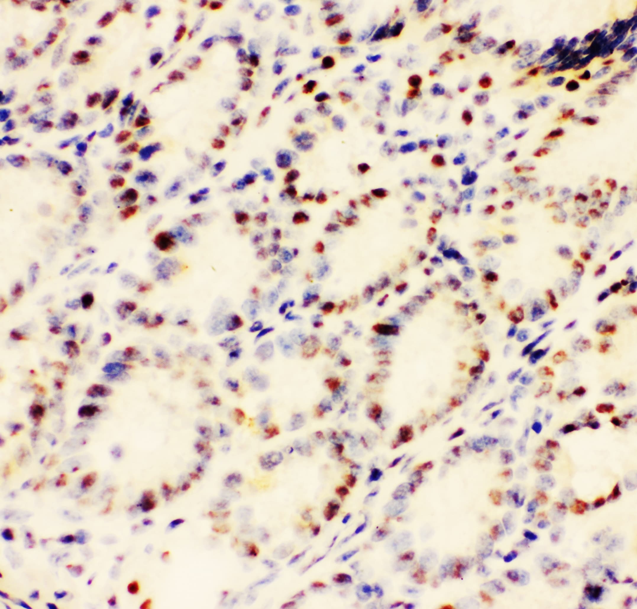 EWSR1 / EWS Antibody (aa369-399)