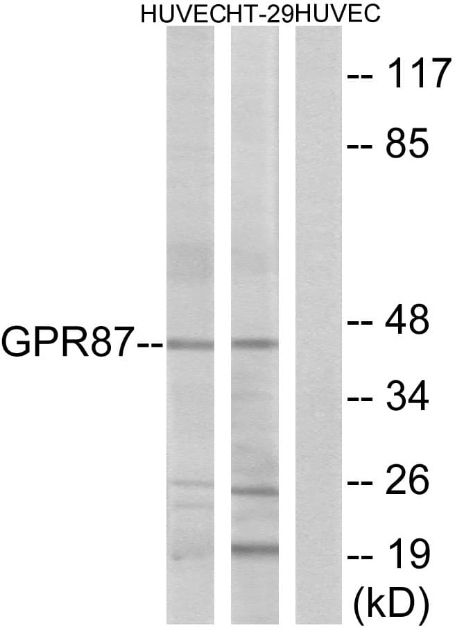 Polyclonal Rabbit anti-Human GPR87 Antibody (aa221-270, IF, WB)