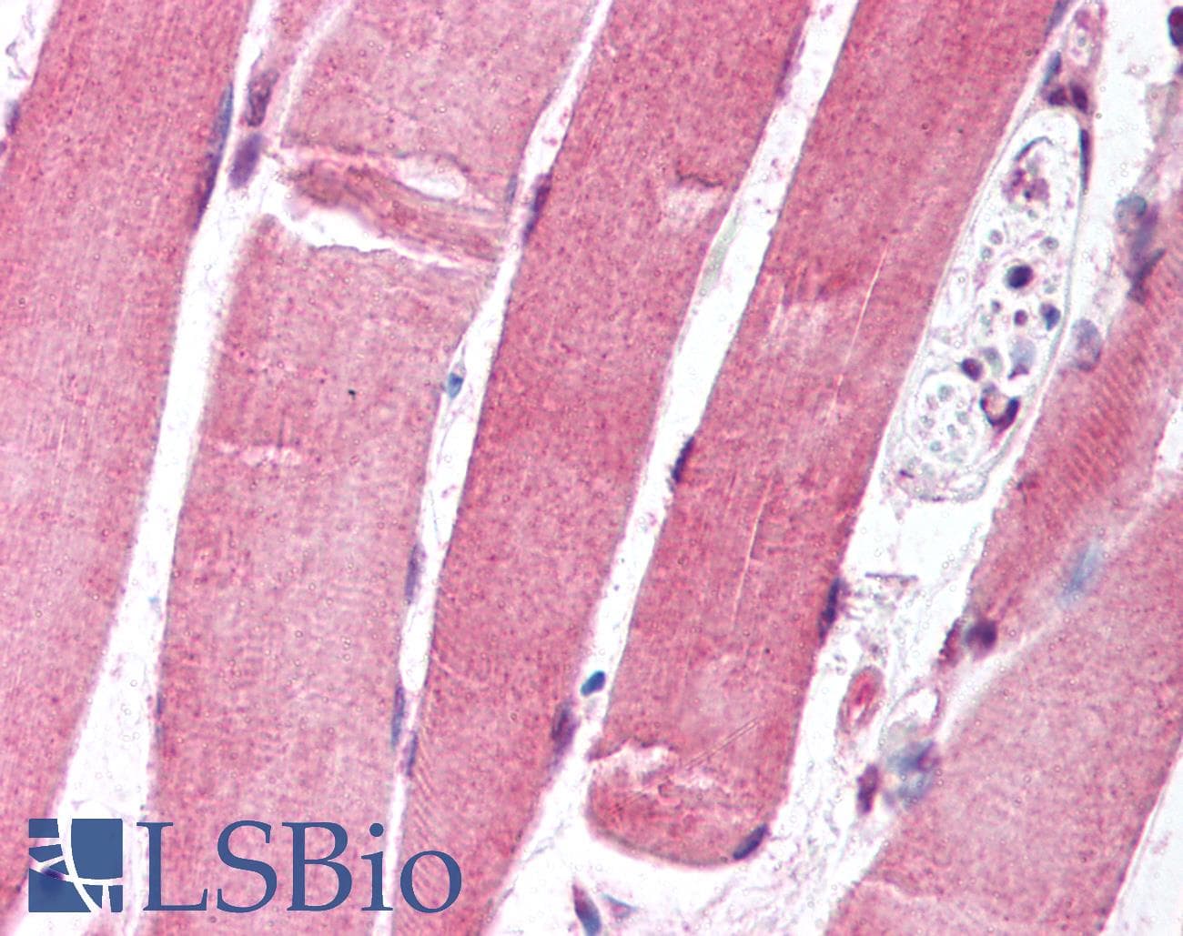 IHC-plus™ Monoclonal Mouse anti-Human FOXO1 / FKHR Antibody (clone 7h3, aa242-655, IHC, WB)