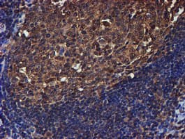 PSMB9 Antibody (clone OTI2B6)