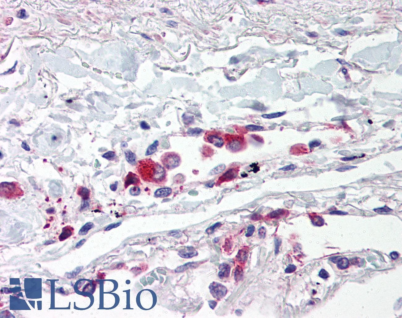 IHC-plus™ Polyclonal Rabbit anti-Human TLR5 Antibody (IHC, WB)