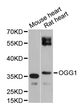 Polyclonal Rabbit anti-Human OGG1 Antibody (IHC, WB)