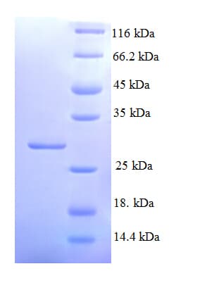 Human KCNJ1 / ROMK Protein (Recombinant His)