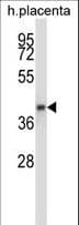 IHC-plus™ GNAQ Antibody (aa52-78)