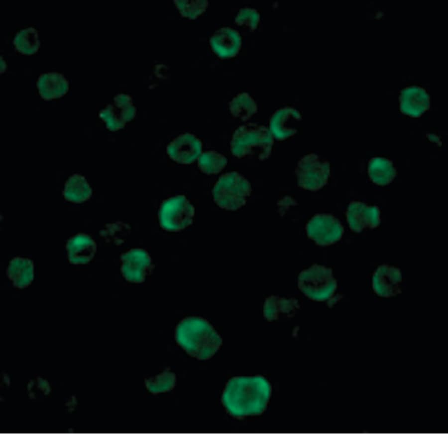 TNFRSF10B / Killer / DR5 Antibody