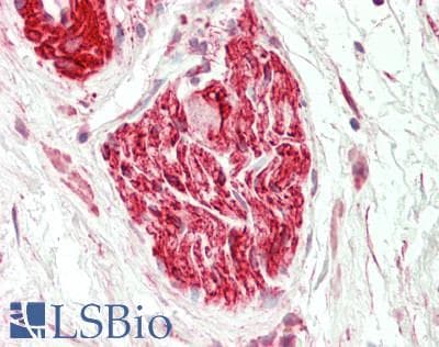 IHC-plus™ Polyclonal Rabbit anti-Human MAP4 Antibody (aa1102-1152, IHC, WB)