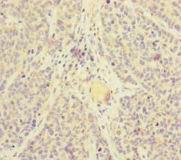 SKIV2L / SKI2 Antibody
