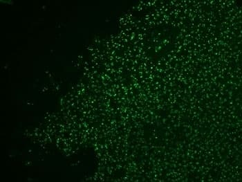 NCL / Nucleolin Antibody (aa364-365, clone 364-5 + NCL/902, Ready-to-Use)