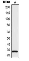 TSPAN9 Antibody (Internal)