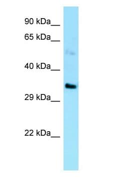 EBNA1BP2 Antibody (C-Terminus)