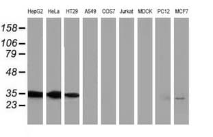 ANXA3 / Annexin A3 Antibody (clone OTI5G4)