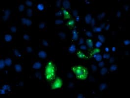 Monoclonal Mouse anti-Human AP50 / AP2M1 Antibody (clone OTI1C8, aa97-383, IF, WB)