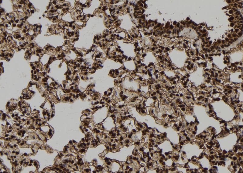 ARRB1 / Beta Arrestin 1 Antibody