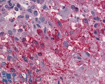IHC-plus™ Polyclonal Rabbit anti-Human ADGRG1 / GPR56 Antibody (Cytoplasmic Domain, IHC)
