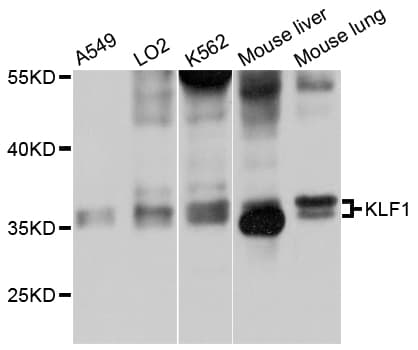 EKLF / KLF1 Antibody