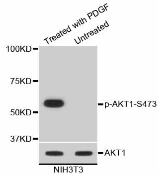 Monoclonal Rabbit anti-Human AKT1 Antibody (phospho-Ser473, IHC, IF, WB)