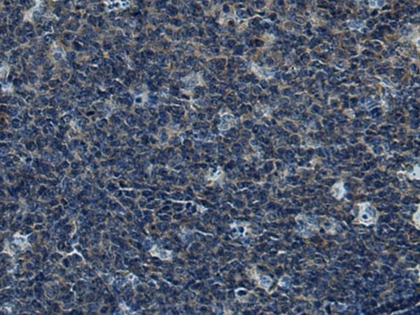 Polyclonal Rabbit anti-Human CUL5 / Cullin-5 Antibody (IHC)