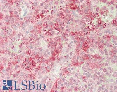 IHC-plus™ TNFSF10 / TRAIL Antibody (aa 39-281)