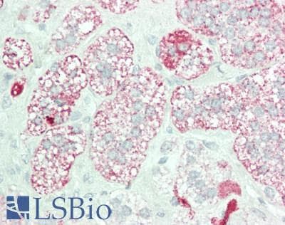IHC-plus™ GALNT1 Antibody (clone 3C10)