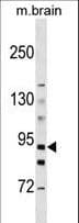 HK3 / Hexokinase 3 Antibody (aa760-789)