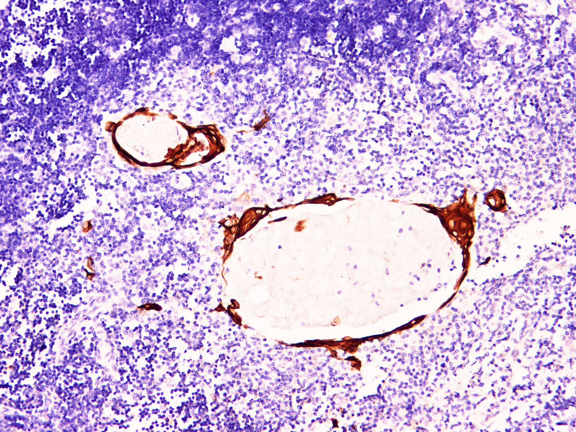 KRT10 / CK10 / Cytokeratin 10 Antibody