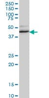 IHC-plus™ RBFOX2 / RBM9 Antibody (clone 4G3)