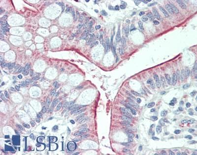 IHC-plus™ CCL17 / TARC Antibody
