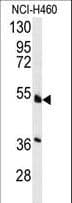 Polyclonal Rabbit anti-Human HNF4A / HNF4 Antibody (Ser142, WB)