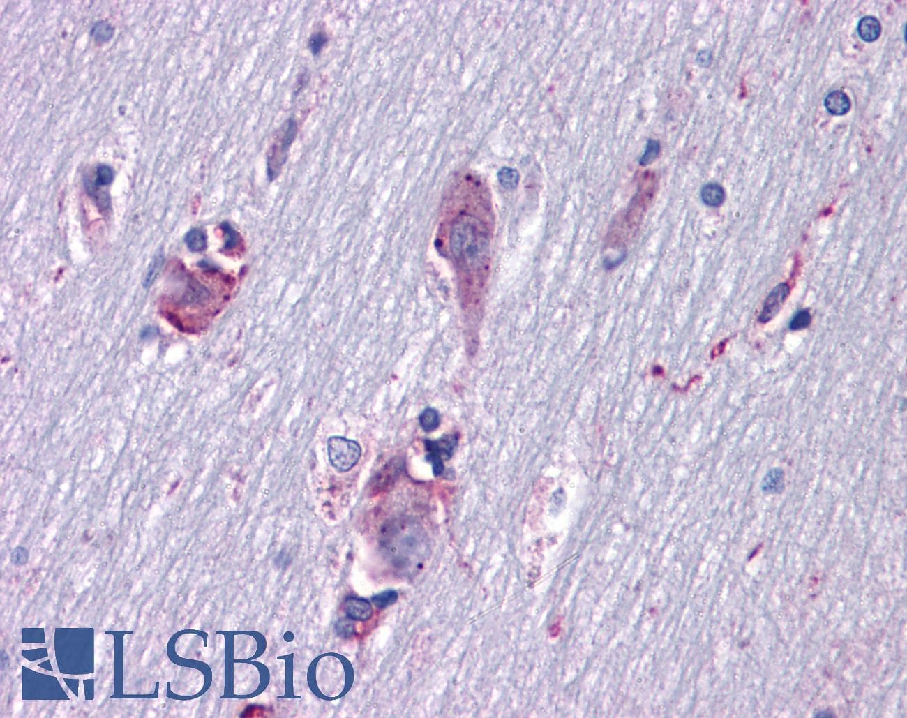 IHC-plus™ ISLET-1 / ISL1 Antibody (aa 150-349, clone 1H9)
