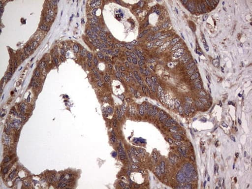 Monoclonal Mouse anti-Human ARAF / ARAF1 / A-RAF Antibody (clone OTI2G9, aa145-365, IHC, WB)