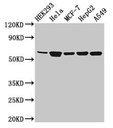 CYP4F22 Antibody