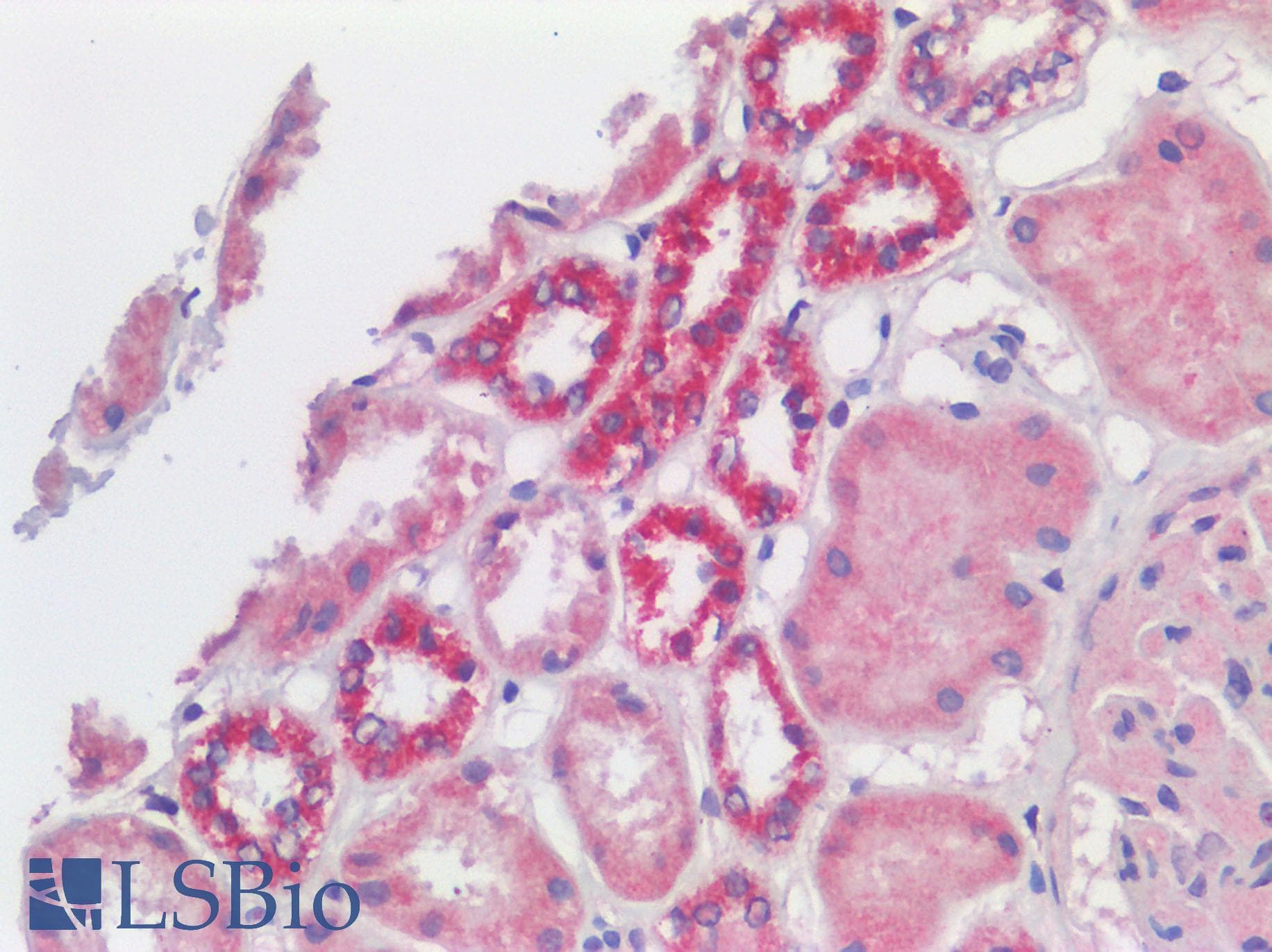 IHC-plus™ VDAC2 Antibody (C-terminal domain of human)