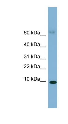 SAA4 Antibody (C-Terminus)