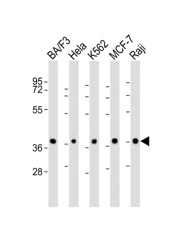 Polyclonal Rabbit anti-Human PPP2R4 Antibody (aa3-35, WB)