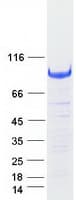 Human NRP1 / Neuropilin 1 Protein (Recombinant Myc-DDK (Flag))