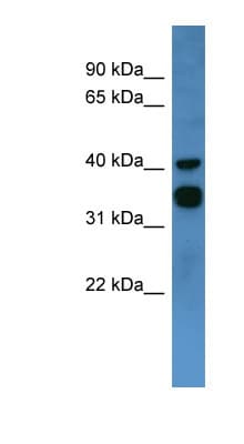 F2RL2 / PAR3 Antibody (C-Terminus)