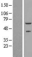 ZNF232 Protein (Over-Expression Lysate Myc-DDK (Flag))