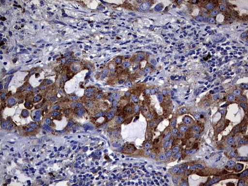 Monoclonal Mouse anti-Human CD63 Antibody (clone OTI2G6, IHC, WB)