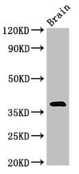 MATH2 / NEUROD6 Antibody