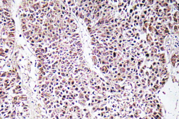 GDF9 / GDF-9 Antibody (aa273-322)
