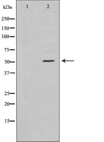 TRIM21 / RO52 Antibody